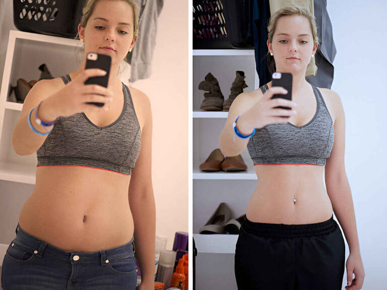 Weight Loss Transformation